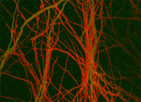 El hongo Trichoderma atroviride.