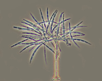 En la imagen, hongo microscópico saprobio Speirosis scopiformis visto a través del microscopio. Estos organismos son un recurso de alto potencial biotecnológico.