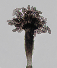 En la imagen, hongo microscópico saprobio  Virgatospora echinofibrosa visto a través del microscopio.