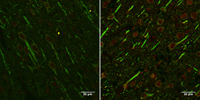Imagen de corte de cerebro de rata GFP-LC3. Izquierda: rata de 4 meses, en verde se ve una proteína que solo producen las neuronas; en rojo se ve una proteína que producen las células senescentes. Derecha: rata de 25 meses, en las neuronas de animales de esta edad el rojo es más intenso, lo que indica que producen más de esa proteína.