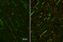Imagen de corte de cerebro de rata GFP-LC3. Izquierda: rata de 4 meses, en verde se ve una proteína que solo producen las neuronas; en rojo se ve una proteína que producen las células senescentes. Derecha: rata de 25 meses, en las neuronas de animales de esta edad el rojo es más intenso, lo que indica que producen más de esa proteína.