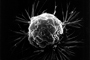 Célula en el cáncer de mama observada con microscopio electrónico de barrido.