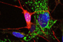 Las células gliales envolventes (rojo) son foco de atención para la medicina regenerativa. En la imagen cultivo primario de capa de nervios olfatorios de ratón, donde se muestra la célula marcada con un anticuerpo.