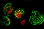 Células de insecto expresando VP6 de rotavirus.  En rojo se muestran los núcleos y en verde los nanotubos de rotavirus detectados por inmunofluorescencia. Micrografía por Jimmy A. Mena.